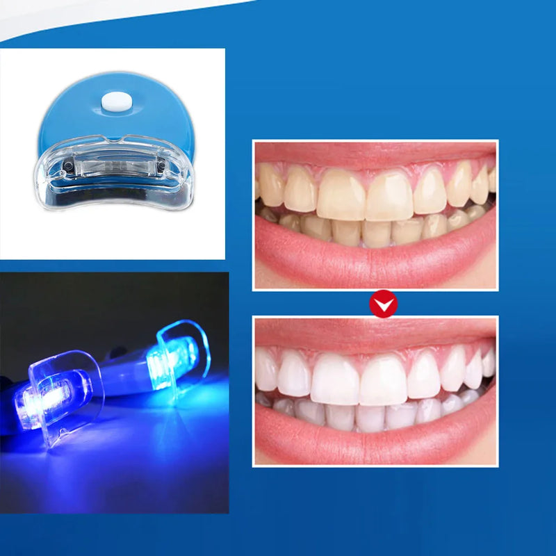 Clareamento Dentário com LED UV | Tecnologia Profissional para Resultados Rápidos em Casa